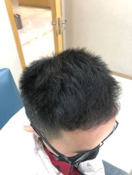 点击看大图 -大麦微针植发丨全国连锁