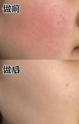 -美玫美容SPA护理中心