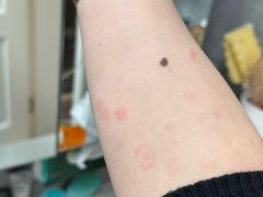 -复旦大学附属华山医院(总院)