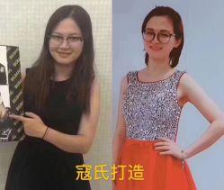 -苗塑堂减肥艾灸