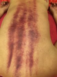 -兰派国际美容养生SPA