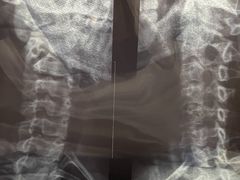 -龙脊康·颈肩腰腿痛·脊柱侧弯·运动损伤脊柱专科门诊(天河店)