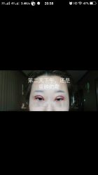点击看大图 -天津伊美尔医疗整形美容专科医院