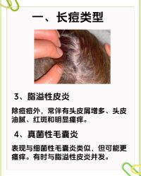 -Bollins波林丝•专研护发中心