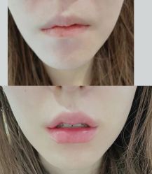 -上海漾颜医疗美容