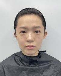 -天津健丽·去眼袋医疗美容机构