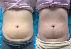 -产后帮产后修复(首城国际店)