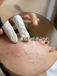 点击看大图 -MLP美丽派·问题肌疗愈中心