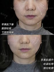 -Yestar重庆艺星医疗美容医院