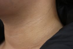 -丰联丽格医疗美容·联合丽格眼整形中心