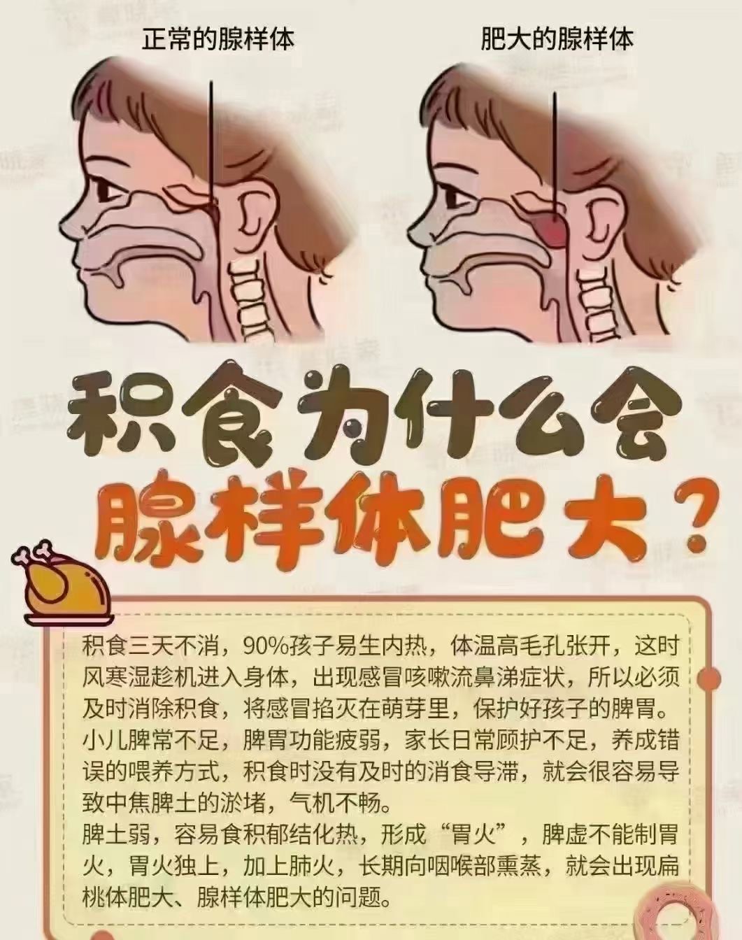 腺样体调理