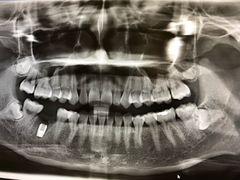 -佛山中大口腔医院·市二级口腔专科医院