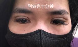 体验后-上海宏康医院·医疗美容科