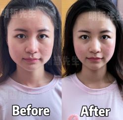 -颜和骨正&明星徒手小颜整骨