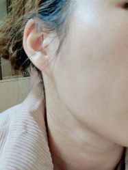 体验后-上海玫瑰医疗美容医院