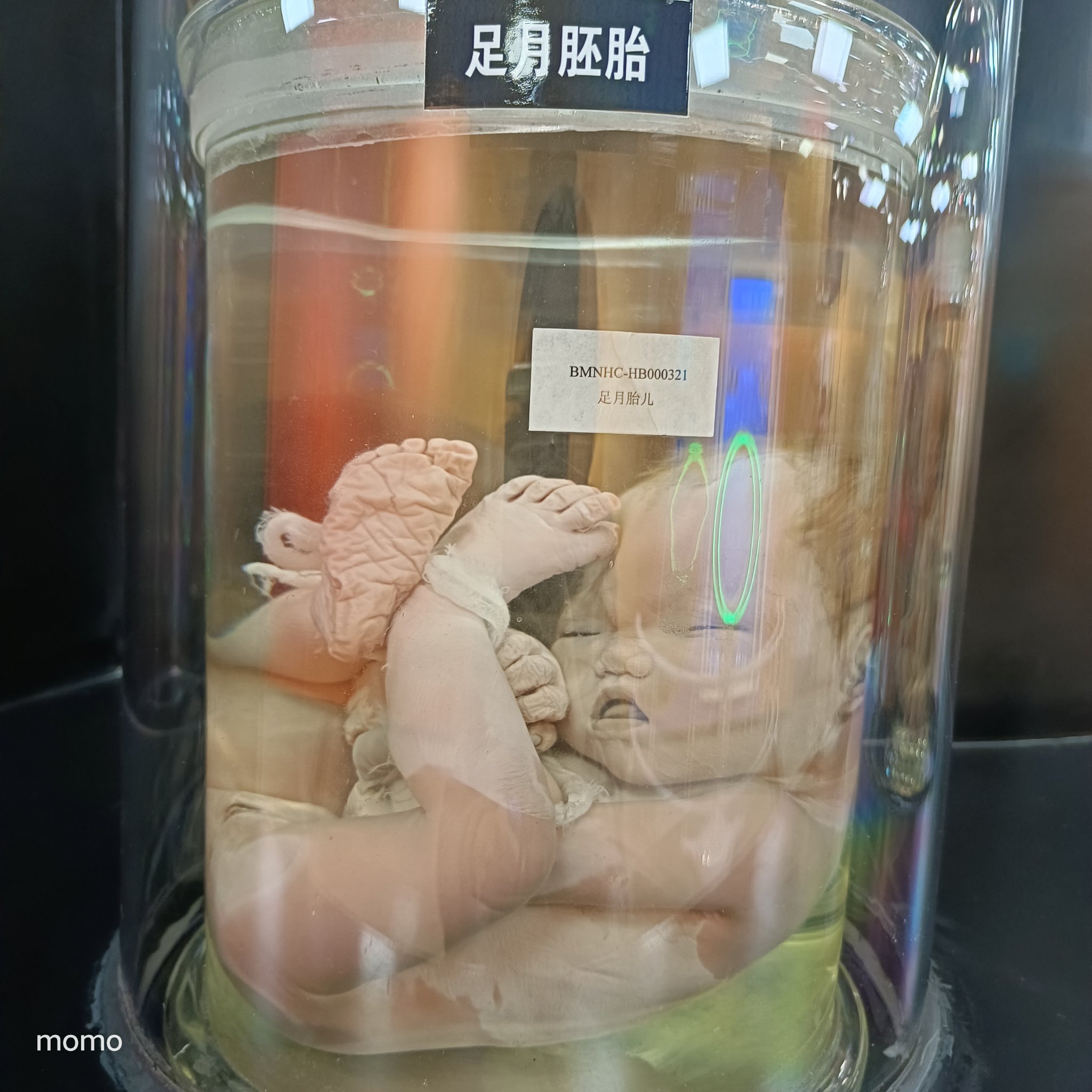 胚胎宝宝�变化记