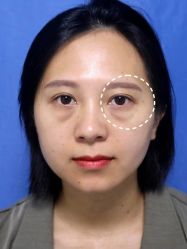 -天津健丽·去眼袋医疗美容机构