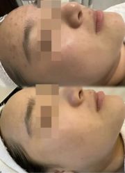 -禾壹净·素颜美问题肌肤修护中心