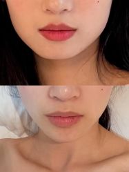 点击看大图 -南京康美美容医院·旗舰店