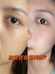 -慕颜医疗美容·皮肤微整 抗衰