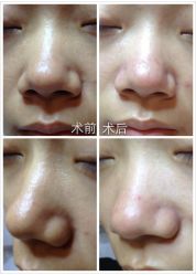 光SPA水氧+opt-光SPA科技美肤