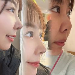 -北京米扬丽格医疗美容·联合丽格鼻整形中心