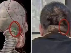 -莱仪堂艾灸经络养生馆(九亭一店)