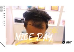 -大麦微针植发全国连锁