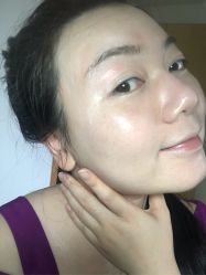 体验后-紫洁俪方（北京）医疗美容