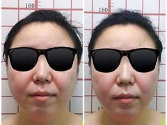 -修申骨雕小颜脊柱骨盆管理产后修复