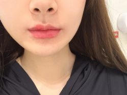 -广州美莱医疗美容医院