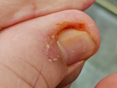 -郑远元专业修脚房·按摩·肉刺·灰指甲(天润城店)