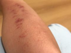 -雅享养生·中医调理·筋骨艾灸(广兰路店)