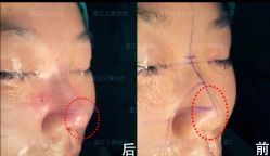 -北京米扬丽格医疗美容·联合丽格鼻整形中心