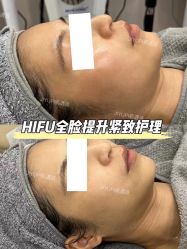 -MLP美丽派·问题肌疗愈中心