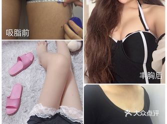 吸脂，医生不会告诉你这些