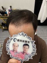 -唐风采假发补发定制