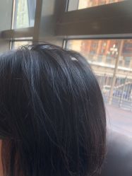 -碧莲盛·不剃发植发