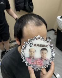 -唐风采假发补发定制