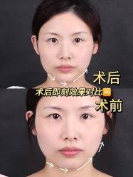 -上海伊莱美医疗美容医院