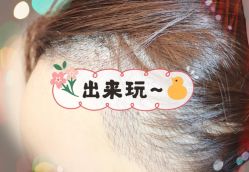 -大麦微针植发全国连锁