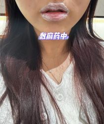 -天津健丽·去眼袋医疗美容机构