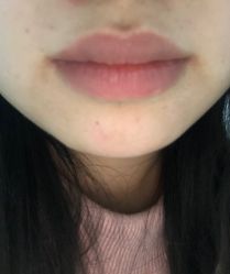 -咪咪专业脱毛连锁机构