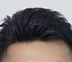 -靓康增发补发假发