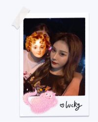 体验后-大麦微针植发全国连锁