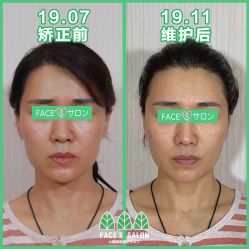 -FACE·日本小颜矫正美容整骨サロン