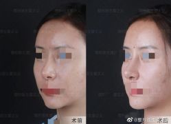 -北京米扬丽格医疗美容·联合丽格鼻整形中心