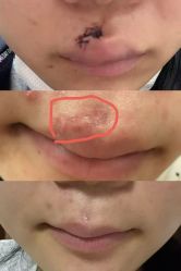 点击看大图 -半岛故事·法儿曼抗衰·indiba中心