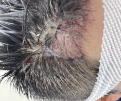 -熙朵美学植发·连锁品牌