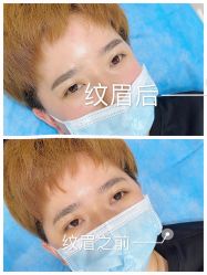 -西施无菌半永久纹绣眉眼影唇轻增发纹发际线